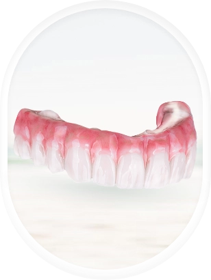 Nano Ceramic All-on-4 dental implants available in Mexico.