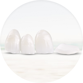 Images showcasing different aspects of veneers treatment