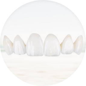 Images showcasing different aspects of veneers treatment