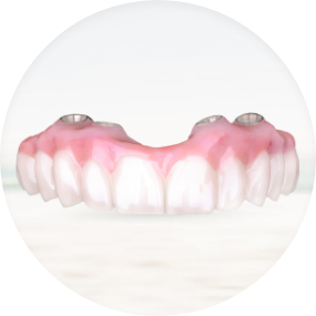 showing the cost-effective zirconia All-on-4 dental implants in Mexico