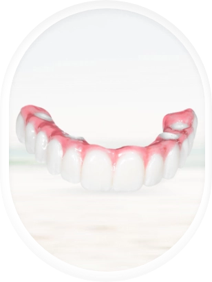 showing the cost-effective zirconia All-on-4 dental implants in Mexico