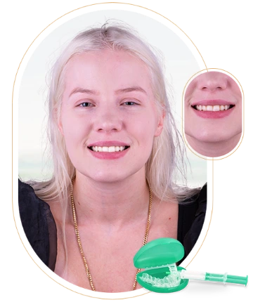 Breakdown of the cost of teeth whitening trays and their effectiveness