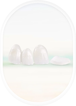 denture lumineers veneers in puerto vallarta