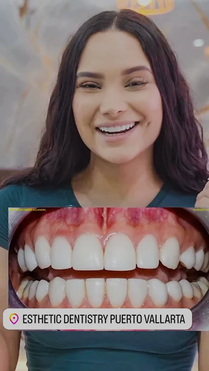 dental work review in puerto vallarta
