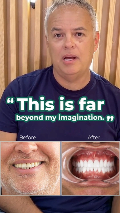 dental work review in puerto vallarta