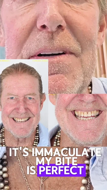 dental work review in puerto vallarta