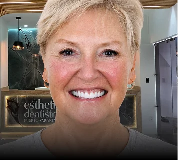 Smiling blonde woman after receiving full-mouth dental treatment.