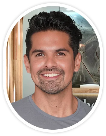 Smiling man portrait for composite veneers treatment example.