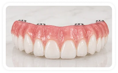 Acrylic dental prosthesis displayed on a white background.