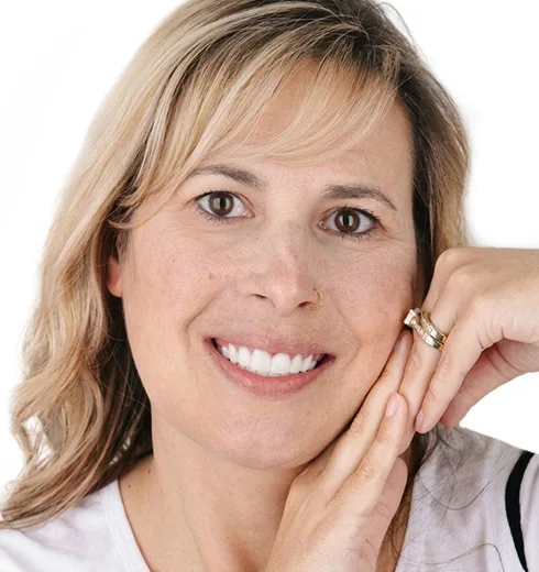 veneers application process in Puerto Vallarta.
