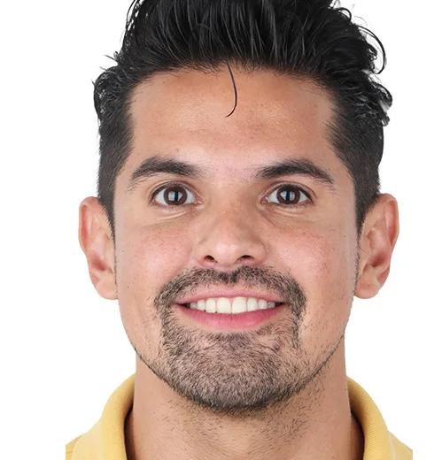 Before and after comparison of veneer treatment in Puerto Vallarta.