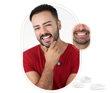 Porcelain Veneers Cost In Mexico, highlighting the minimal and effective transformation.